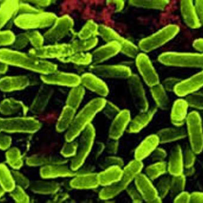 Timeline: Historia de la Microbiología (S.XIX-XX)