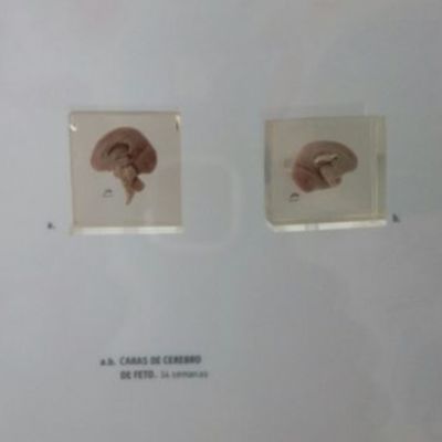 Timeline: Etapa Embrionaria