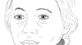 Timeline: The Life and Times of Kathe Kollwitz