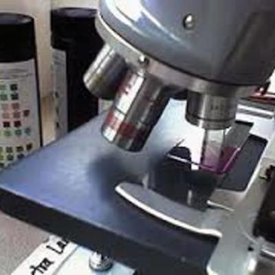 Timeline: TINCIÓN DE GRAM