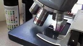 Timeline: TINCIÓN DE GRAM