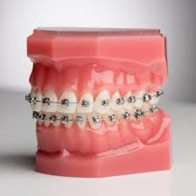 Timeline: Tiana Baca Orthodontist