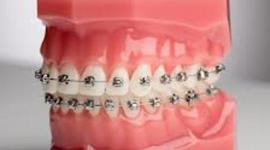 Timeline: Tiana Baca Orthodontist