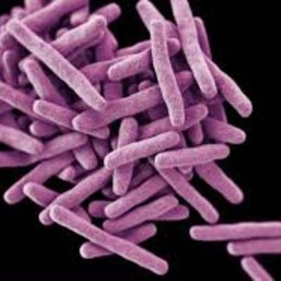 Timeline: The History of the Pathogen by Johann R. Per 1