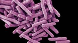 Timeline: The History of the Pathogen by Johann R. Per 1