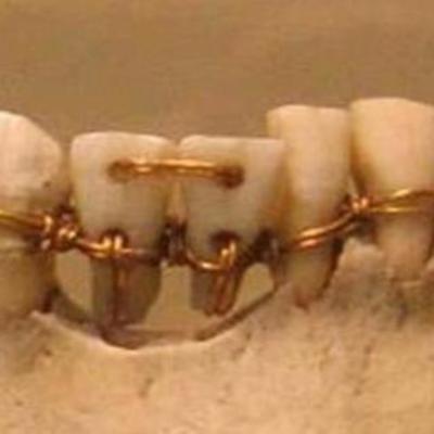 Timeline: The history of cellphone