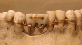 Timeline: The history of cellphone