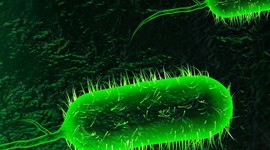 Timeline: Model R 1850 - 1900: Cholera