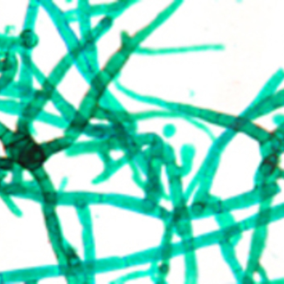 Timeline: Historia de la Microbiologia