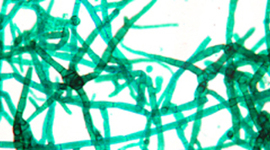 Timeline: Historia de la Microbiologia