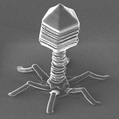 Timeline: Ambialgia Timeline