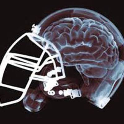Timeline: NFL Concussion Protocol