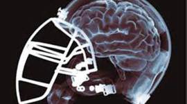Timeline: NFL Concussion Protocol