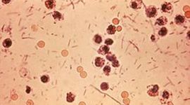 Timeline: HISTORIA DE LA MICROBIOLOGIA