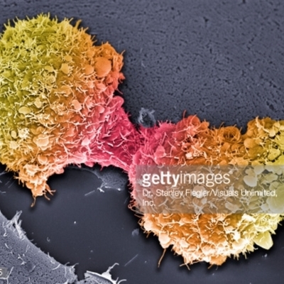 Timeline: Cancer Treatments and Prevention