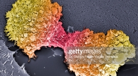 Timeline: Cancer Treatments and Prevention