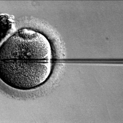 Timeline: La historia de la FIV en Costa Rica