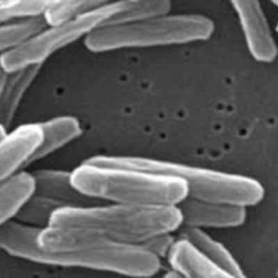 Timeline: History of Tuberculosis By Bridget Hihara 3rd Period