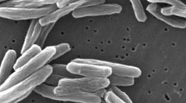 Timeline: History of Tuberculosis By Bridget Hihara 3rd Period