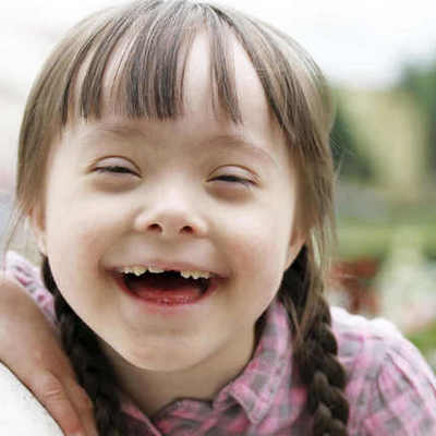 Timeline: Historia Síndrome de Down