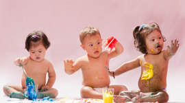 Timeline: Historia del sindrome de down