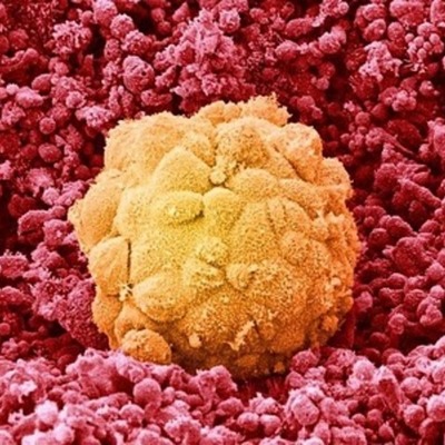 Timeline: Ontogénesis