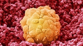 Timeline: Ontogénesis