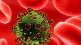 Timeline: Brief History of Germs Timeline: HIV/AIDS  by Roger Wang, Period 1