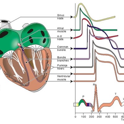 Timeline: Timeline Electrcoardiografo Bruce