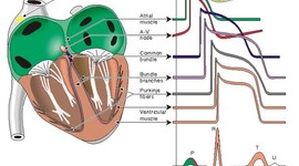 Timeline: Timeline Electrcoardiografo Bruce