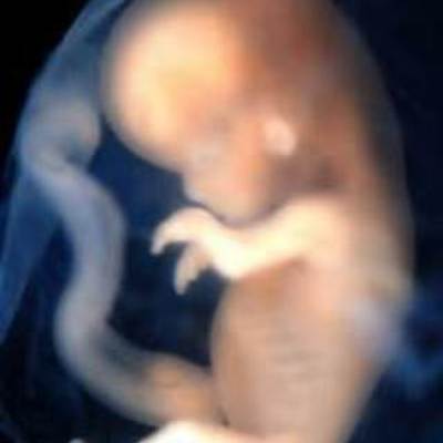 Timeline: Fetal Development