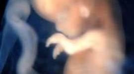 Timeline: Fetal Development