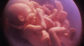 Timeline: The Miracle of Life