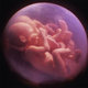 Babies in womb embryos