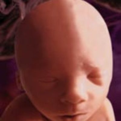 Timeline: Fetal Development