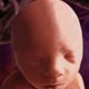 20weeks fetus