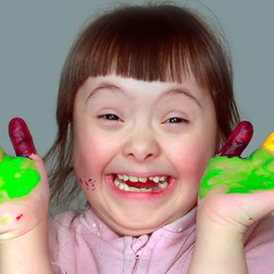 Timeline: sindrome de Down