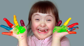 Timeline: sindrome de Down