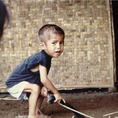 Timeline: LA DESNUTRICIÓN