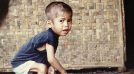 Timeline: LA DESNUTRICIÓN