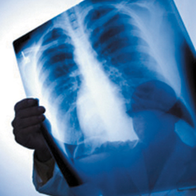 Timeline: Radiología