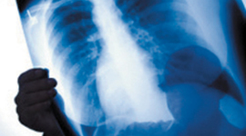 Timeline: Radiología