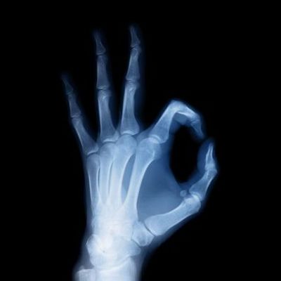 Timeline: Evolución Histórica De Los Rayos X