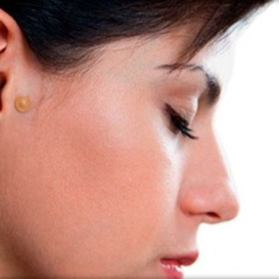 Timeline: Auriculoterapia