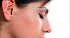 Timeline: Auriculoterapia