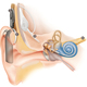 Cochlear implant