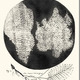 Roberthookemicrographia1665 thumb1