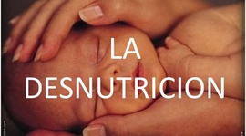 Timeline: La Desnutrición