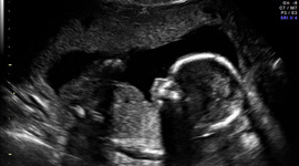 Timeline: From Conception to Birth