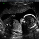 Ultrasound 5